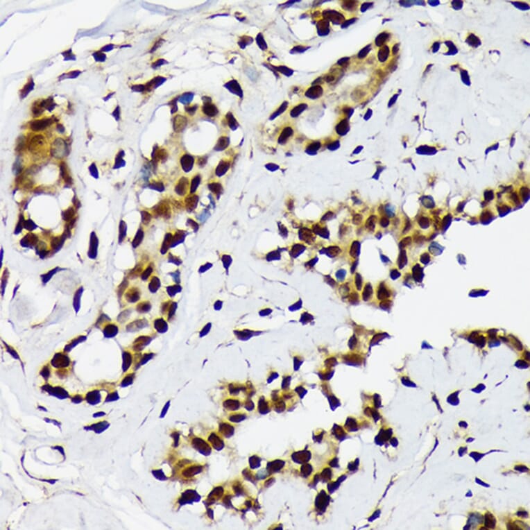 Immunohistochemistry - Anti-ILF2/NF45 Antibody [ARC1621] (A308598) - Antibodies.com
