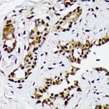 Immunohistochemistry - Anti-ILF2/NF45 Antibody [ARC1621] (A308598) - Antibodies.com