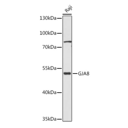 Western Blot - Anti-Cx50 Antibody (A308599) - Antibodies.com