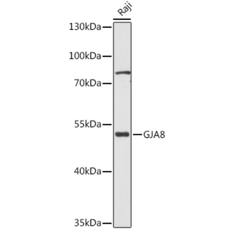 Western Blot - Anti-Cx50 Antibody (A308599) - Antibodies.com