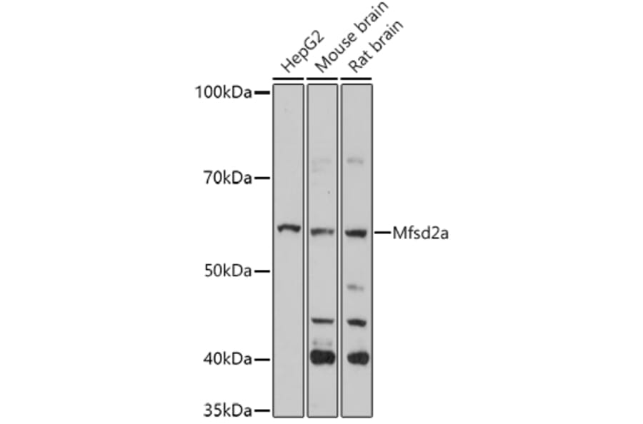 Western Blot - Anti-MFSD2A/NLS1 Antibody (A308600) - Antibodies.com