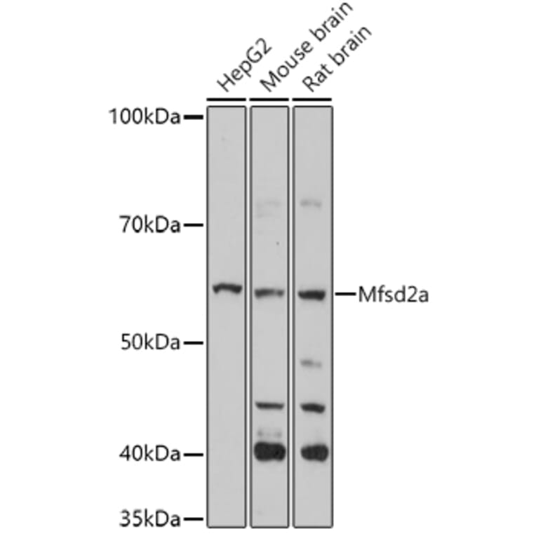 Western Blot - Anti-MFSD2A/NLS1 Antibody (A308600) - Antibodies.com