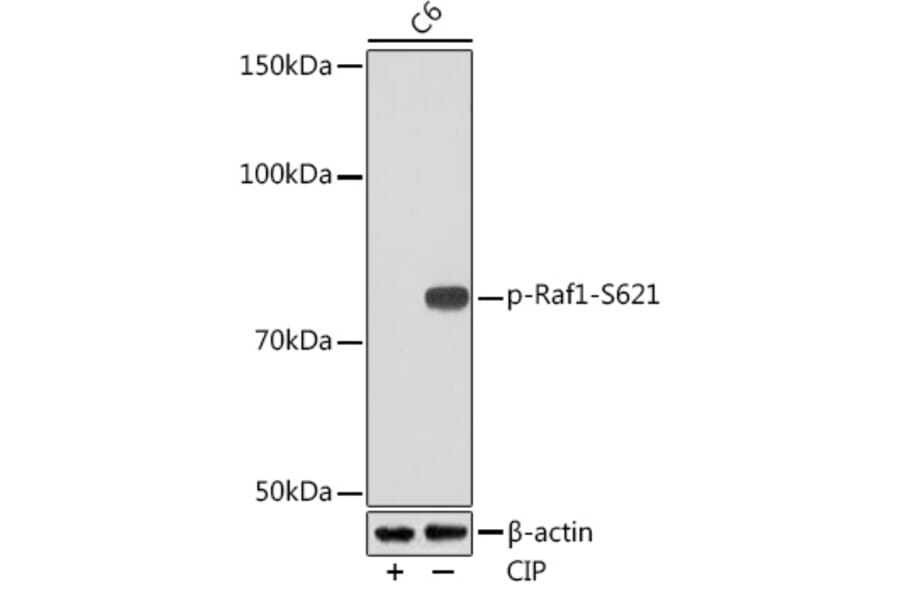 Western Blot - Anti-Raf1 (phospho Ser621) Antibody [ARC1556] (A308602) - Antibodies.com