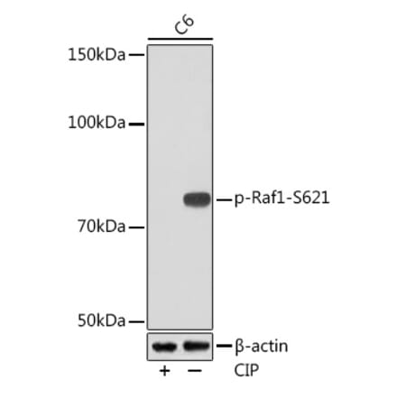 Western Blot - Anti-Raf1 (phospho Ser621) Antibody [ARC1556] (A308602) - Antibodies.com