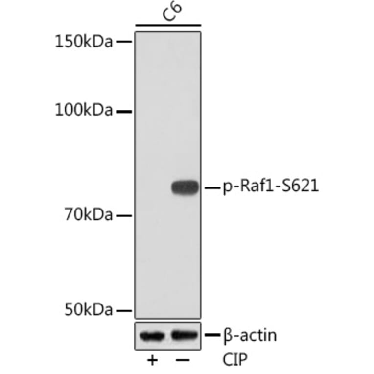 Western Blot - Anti-Raf1 (phospho Ser621) Antibody [ARC1556] (A308602) - Antibodies.com