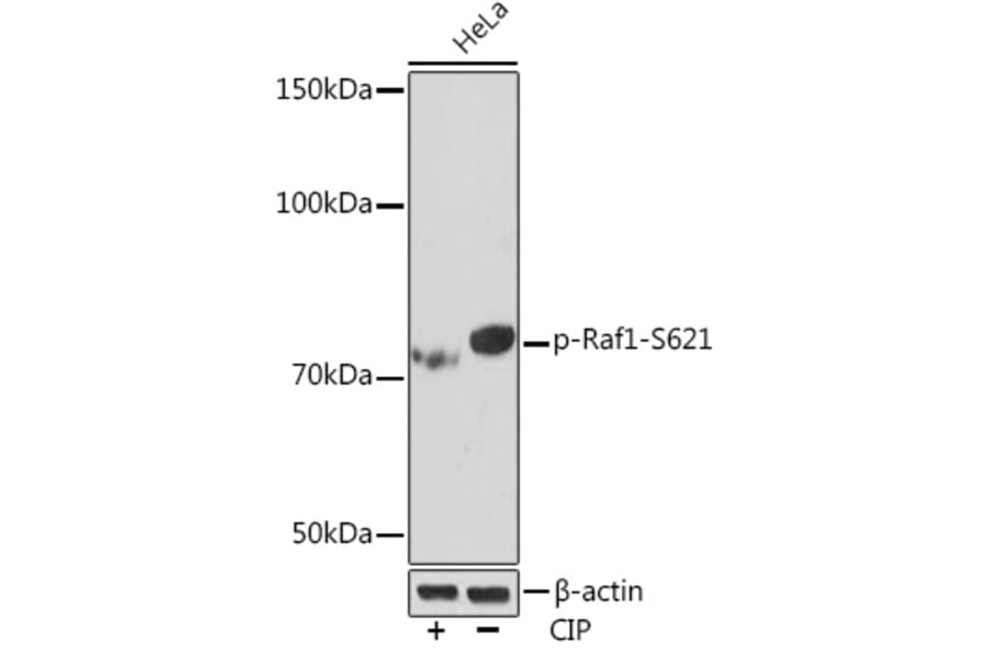 Western Blot - Anti-Raf1 (phospho Ser621) Antibody [ARC1556] (A308602) - Antibodies.com