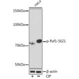 Western Blot - Anti-Raf1 (phospho Ser621) Antibody [ARC1556] (A308602) - Antibodies.com