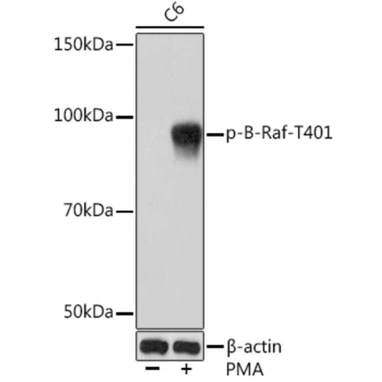 Western Blot - Anti-BRAF (phospho Thr401) Antibody [ARC1587] (A308604) - Antibodies.com