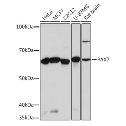 Western Blot - Anti-PAX7 Antibody [ARC0914] (A308605) - Antibodies.com