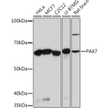 Western Blot - Anti-PAX7 Antibody [ARC0914] (A308605) - Antibodies.com