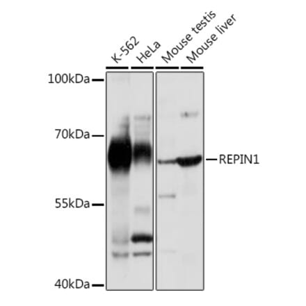 Western Blot - Anti-REPIN1 Antibody (A308606) - Antibodies.com