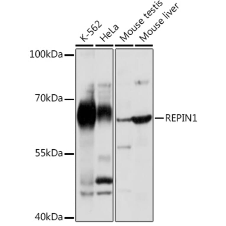 Western Blot - Anti-REPIN1 Antibody (A308606) - Antibodies.com