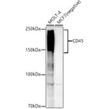 Western Blot - Anti-CD45 Antibody [ARC0459] (A308608) - Antibodies.com