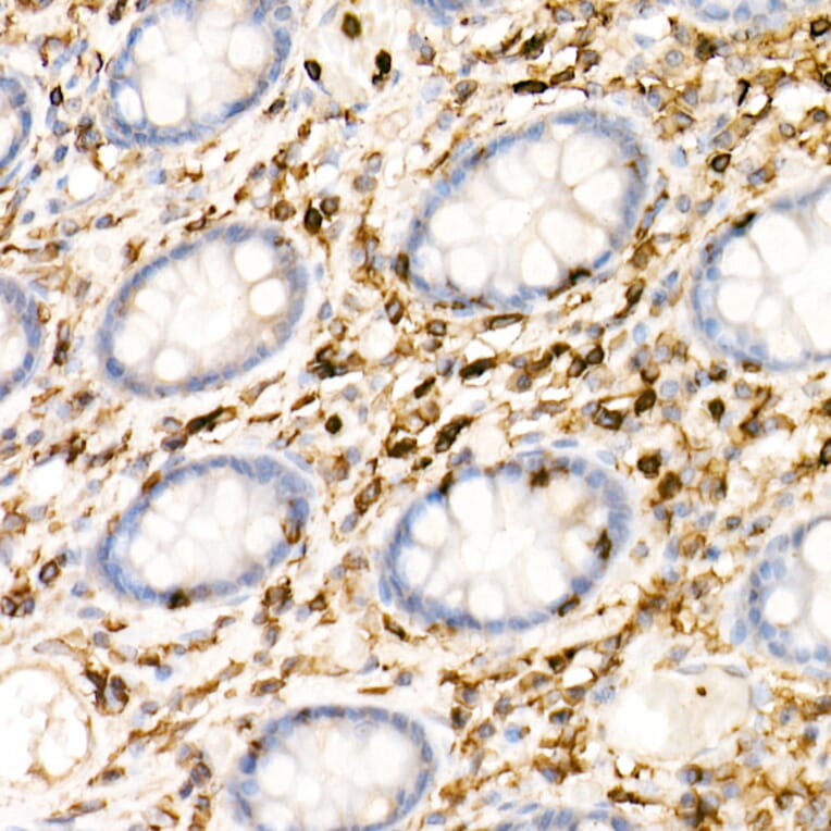 Immunohistochemistry - Anti-CD45 Antibody [ARC0459] (A308608) - Antibodies.com