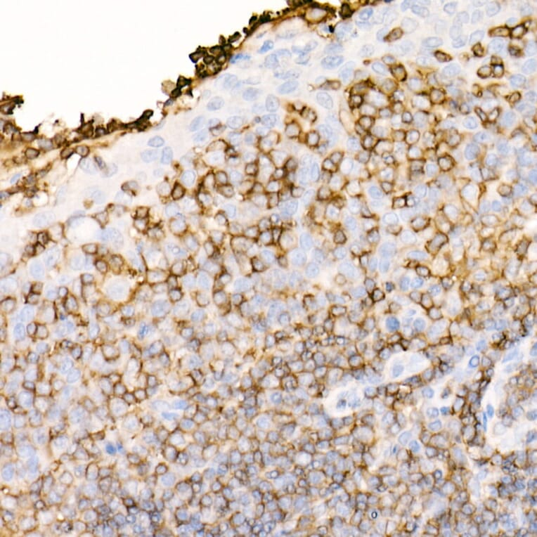 Immunohistochemistry - Anti-CD45 Antibody [ARC0459] (A308608) - Antibodies.com