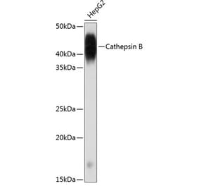 Western Blot - Anti-Cathepsin B Antibody [ARC0395] (A308610) - Antibodies.com