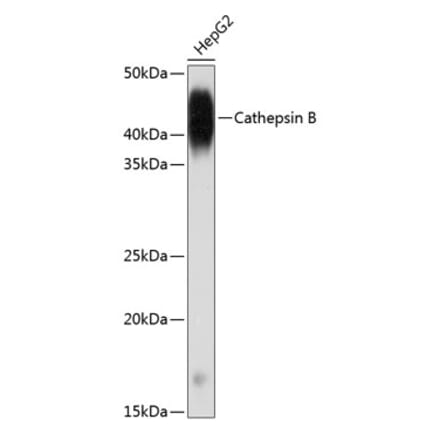 Western Blot - Anti-Cathepsin B Antibody [ARC0395] (A308610) - Antibodies.com