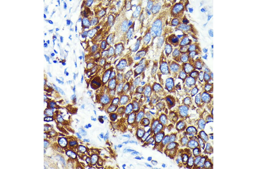 Immunohistochemistry - Anti-Cathepsin B Antibody [ARC0395] (A308610) - Antibodies.com