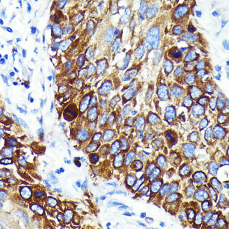 Immunohistochemistry - Anti-Cathepsin B Antibody [ARC0395] (A308610) - Antibodies.com