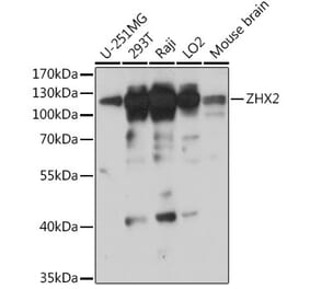 Western Blot - Anti-ZHX2 Antibody (A308611) - Antibodies.com