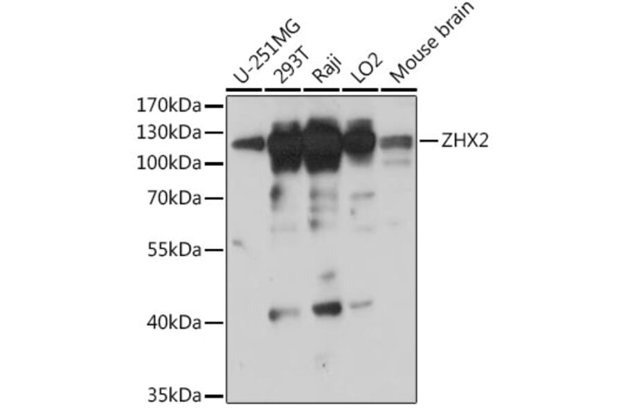 Western Blot - Anti-ZHX2 Antibody (A308611) - Antibodies.com