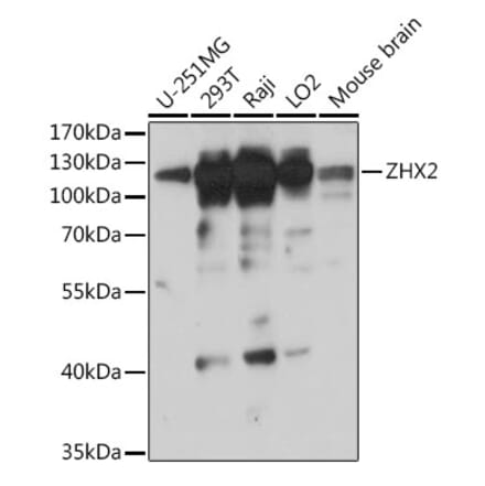Western Blot - Anti-ZHX2 Antibody (A308611) - Antibodies.com