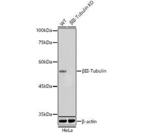 Western Blot - Anti-beta III Tubulin Antibody [AMC0115] (A308612) - Antibodies.com