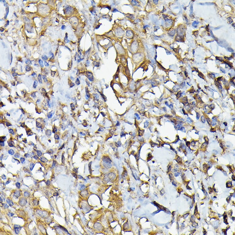 Immunohistochemistry - Anti-Caspase-4 Antibody (A308619) - Antibodies.com