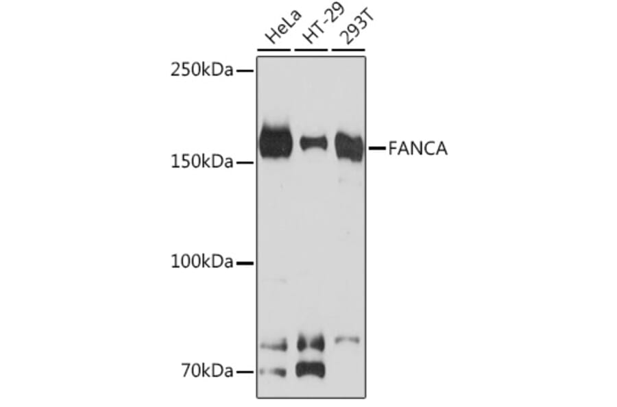 Western Blot - Anti-FANCA/FAA Antibody [ARC1620] (A308620) - Antibodies.com