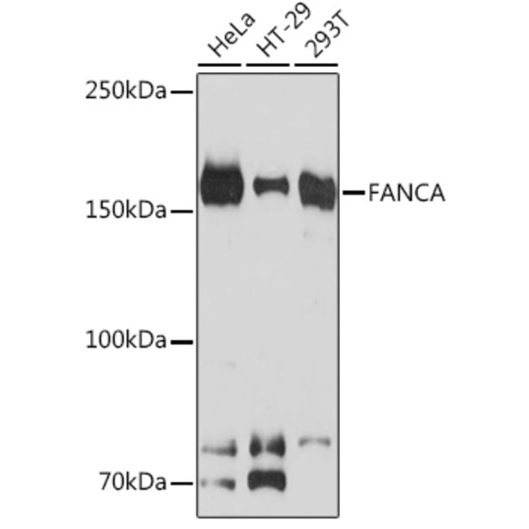 Western Blot - Anti-FANCA/FAA Antibody [ARC1620] (A308620) - Antibodies.com