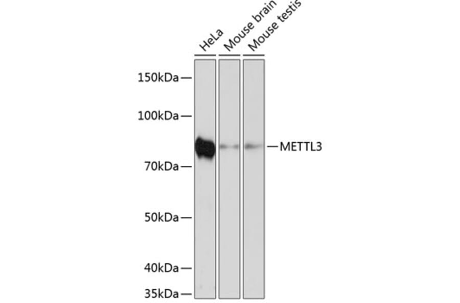 Western Blot - Anti-METTL3 Antibody [ARC0487] (A308621) - Antibodies.com