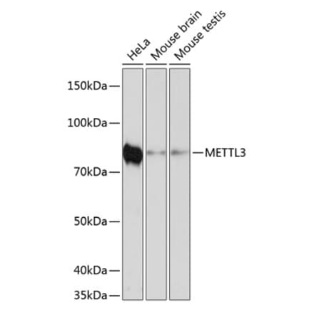 Western Blot - Anti-METTL3 Antibody [ARC0487] (A308621) - Antibodies.com