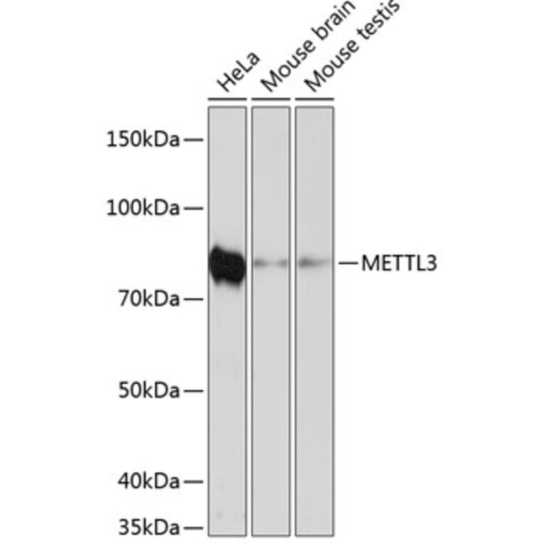 Western Blot - Anti-METTL3 Antibody [ARC0487] (A308621) - Antibodies.com