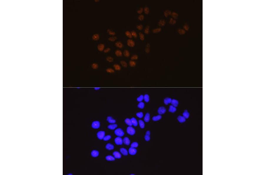 Immunofluorescence - Anti-METTL3 Antibody [ARC0487] (A308621) - Antibodies.com