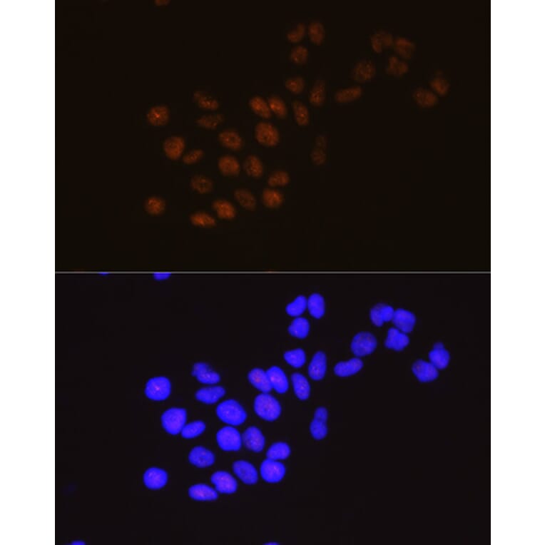 Immunofluorescence - Anti-METTL3 Antibody [ARC0487] (A308621) - Antibodies.com