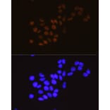 Immunofluorescence - Anti-METTL3 Antibody [ARC0487] (A308621) - Antibodies.com