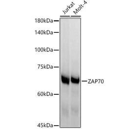 Western Blot - Anti-ZAP70 Antibody [ARC51229] (A308622) - Antibodies.com