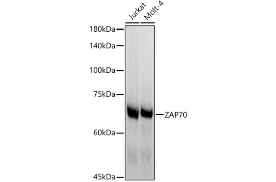 Western Blot - Anti-ZAP70 Antibody [ARC51229] (A308622) - Antibodies.com