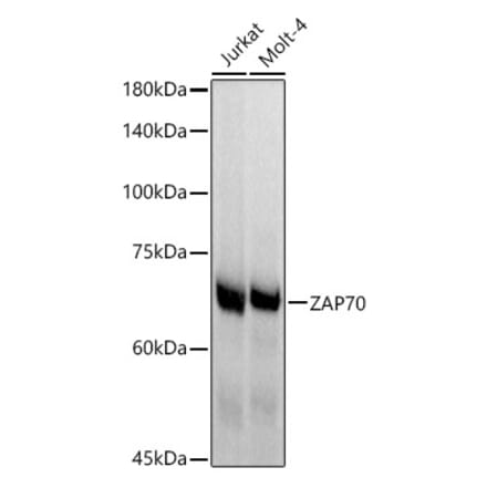 Western Blot - Anti-ZAP70 Antibody [ARC51229] (A308622) - Antibodies.com