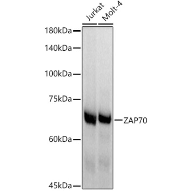 Western Blot - Anti-ZAP70 Antibody [ARC51229] (A308622) - Antibodies.com