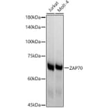 Western Blot - Anti-ZAP70 Antibody [ARC51229] (A308622) - Antibodies.com