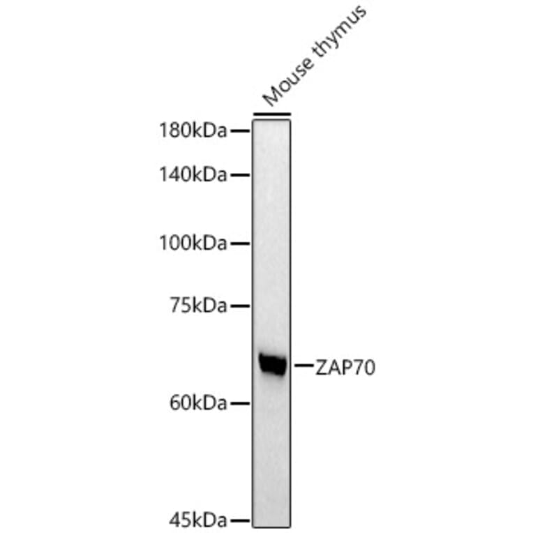 Western Blot - Anti-ZAP70 Antibody [ARC51229] (A308622) - Antibodies.com