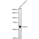 Western Blot - Anti-ZAP70 Antibody [ARC51229] (A308622) - Antibodies.com