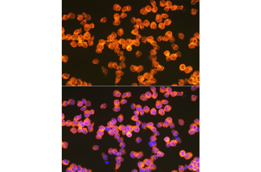 Immunofluorescence - Anti-ZAP70 Antibody (A308622) - Antibodies.com
