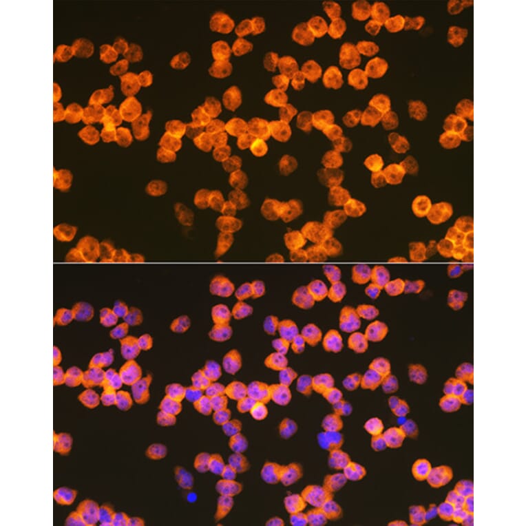 Immunofluorescence - Anti-ZAP70 Antibody (A308622) - Antibodies.com