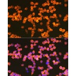 Immunofluorescence - Anti-ZAP70 Antibody (A308622) - Antibodies.com