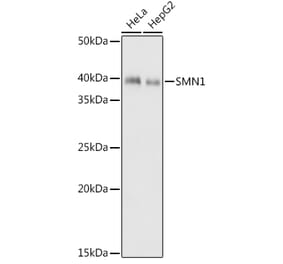 Western Blot - Anti-SMN/Gemin 1 Antibody [ARC1710] (A308623) - Antibodies.com