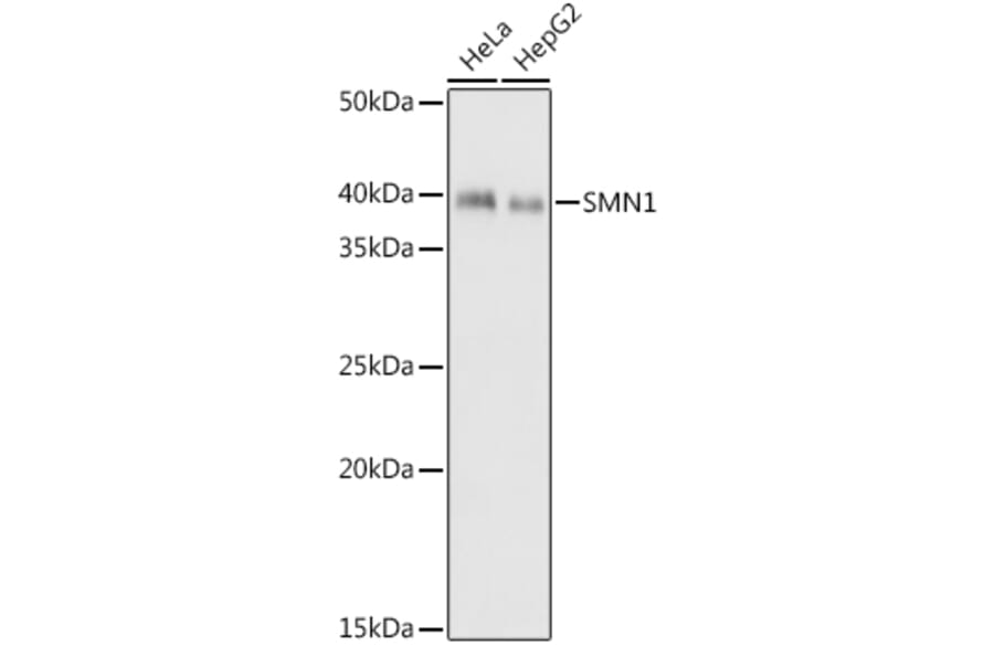 Western Blot - Anti-SMN/Gemin 1 Antibody [ARC1710] (A308623) - Antibodies.com