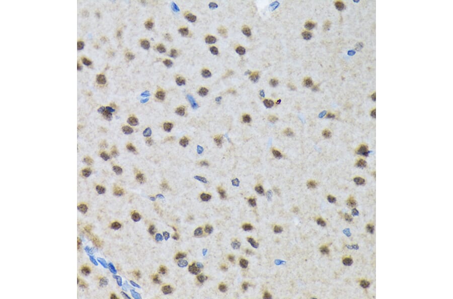 Immunohistochemistry - Anti-SMN/Gemin 1 Antibody [ARC1710] (A308623) - Antibodies.com