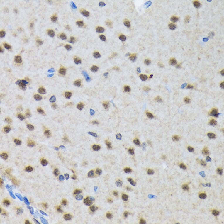 Immunohistochemistry - Anti-SMN/Gemin 1 Antibody [ARC1710] (A308623) - Antibodies.com